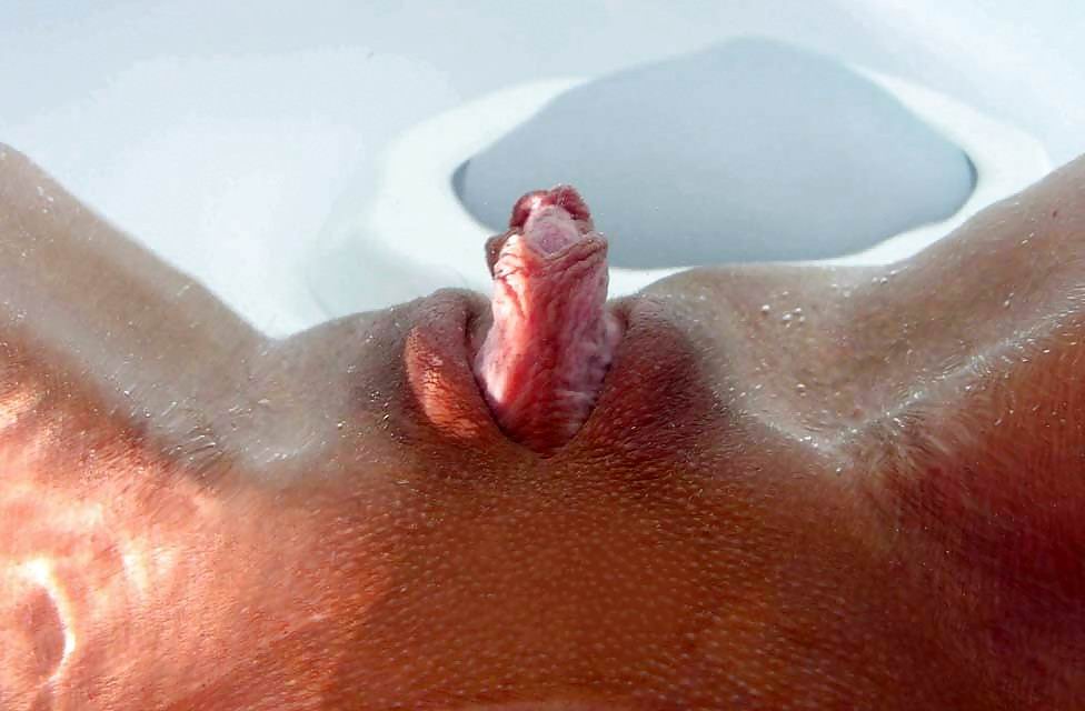 Clitoris Pics Pic Of 20